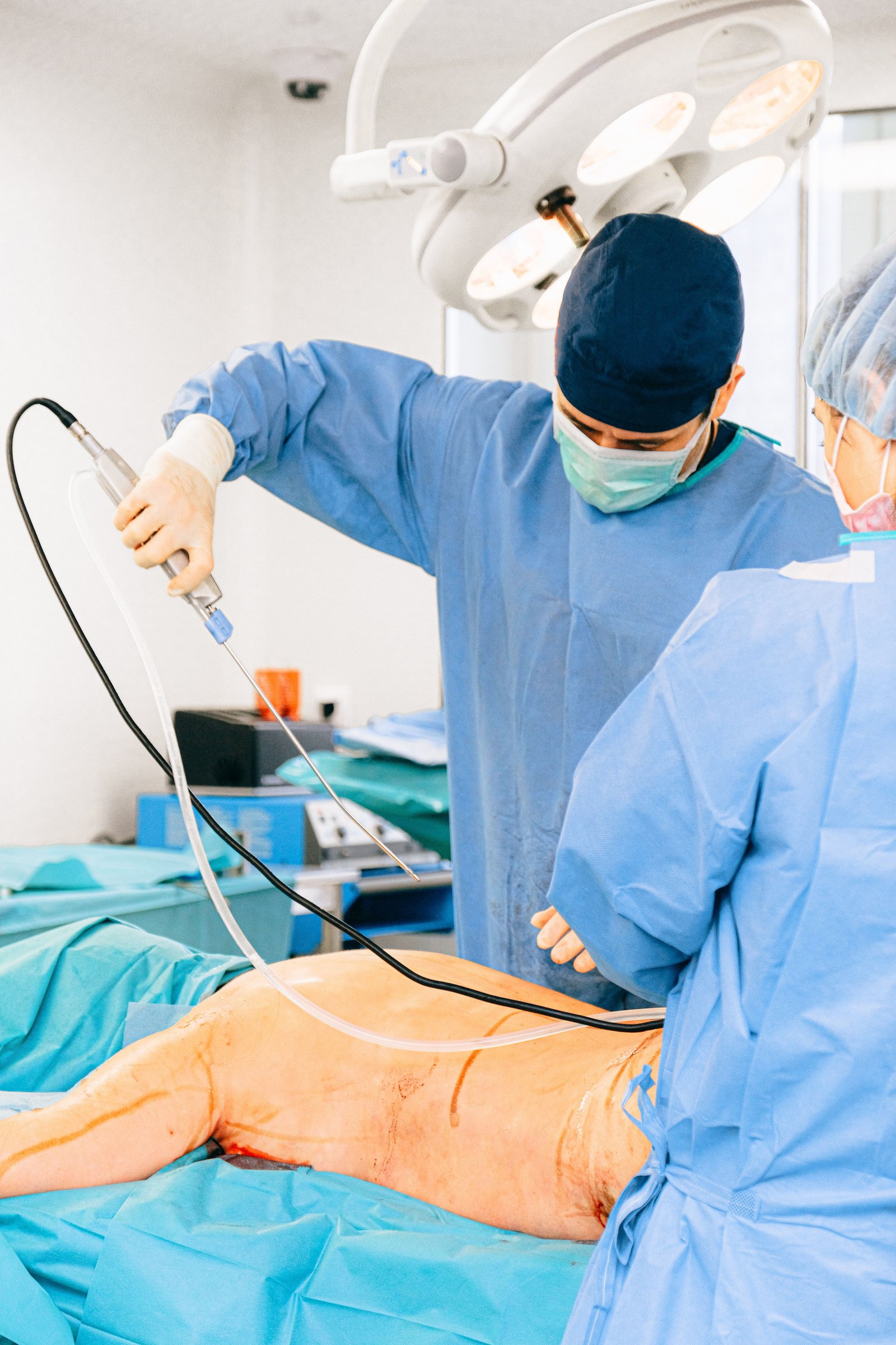 Minimally Invasive Surgery Team
